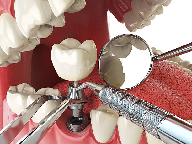 Best Walk-In Emergency Dentist in Stanberry, MO